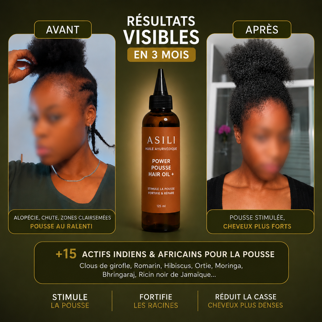 Huile Capillaire Cheveux Crépus – Pousse & Anti-Casse | Asilì