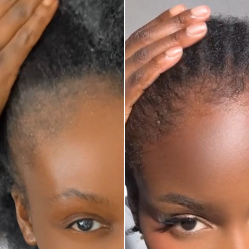 Huile Capillaire Cheveux Crépus – Pousse & Anti-Casse | Asilì