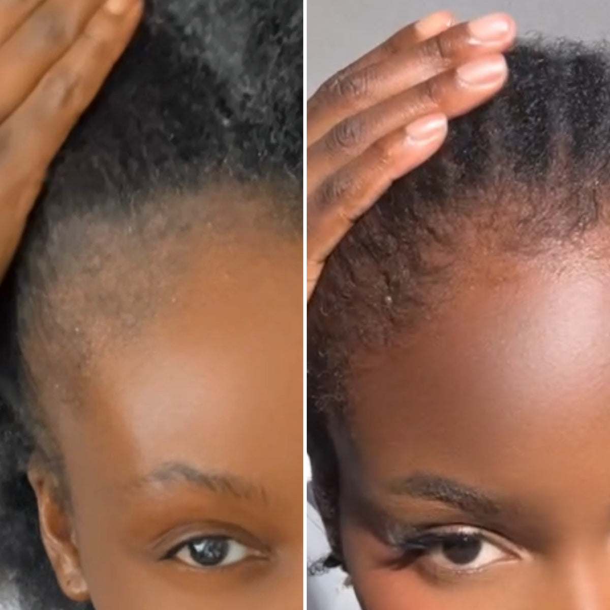 Duo Huile & Baume Cheveux Crépus – Routine Pousse Complète | Asilì